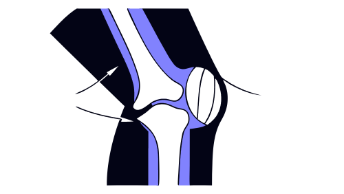 wear test of articular prostheses
